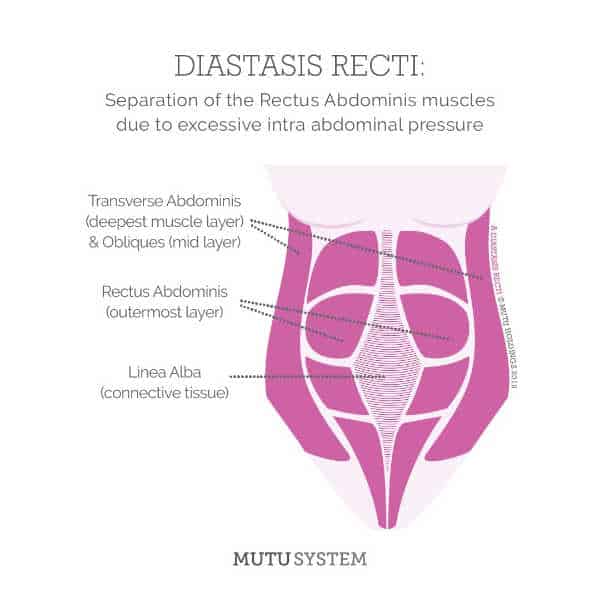 Do you have diastasis recti as a military spouse. Mutu strong is a specific program to help you heal.